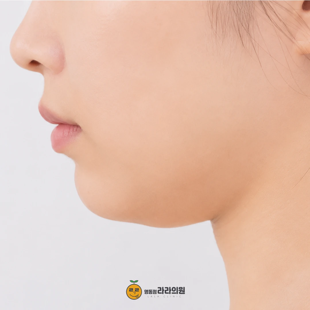 사각턱 보톡스 가격·주기, 저작근과 침샘부터 구분해보세요