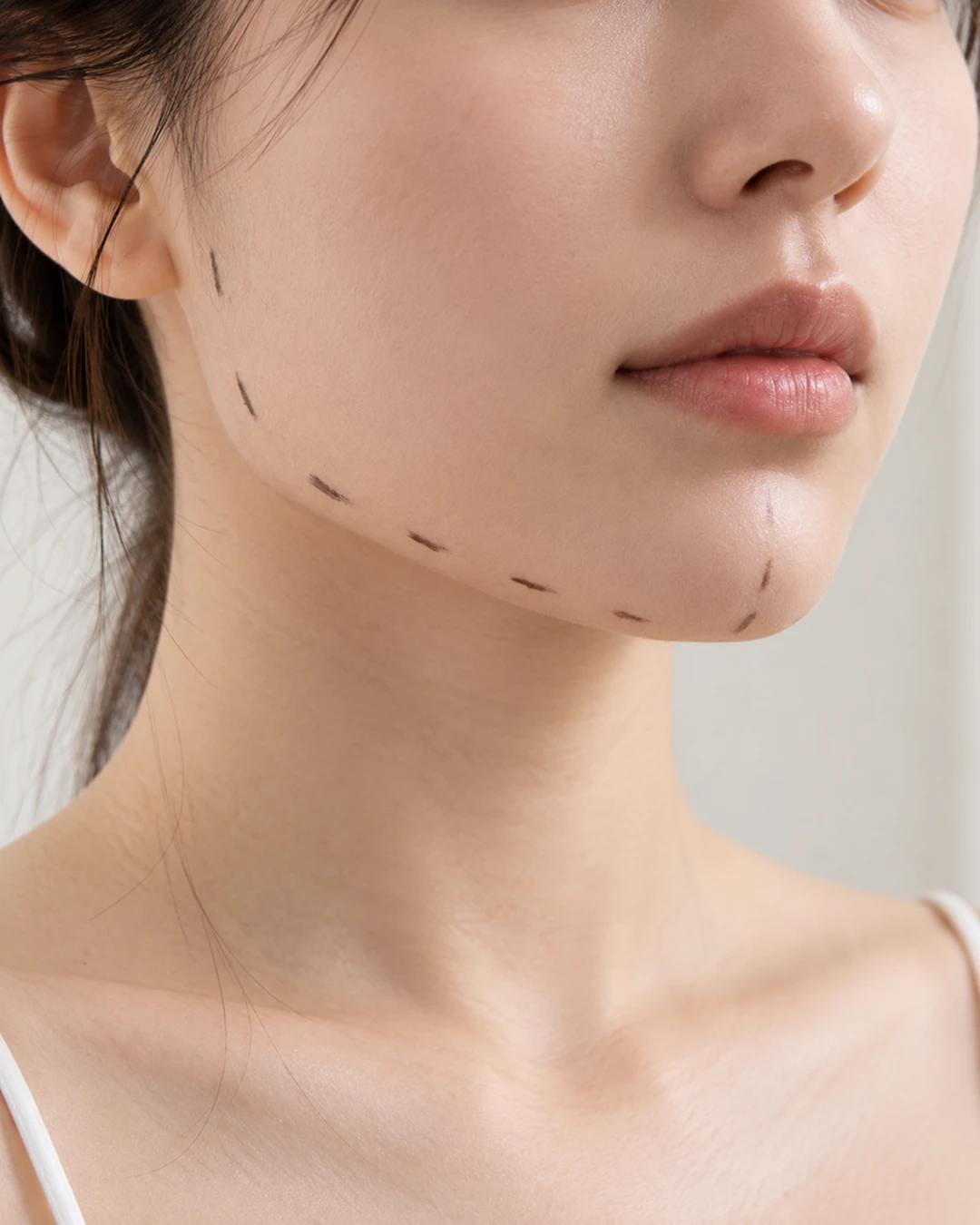 귀밑·턱밑 침샘보톡스, 얼굴 라인이 고민될 때 확인할 내용