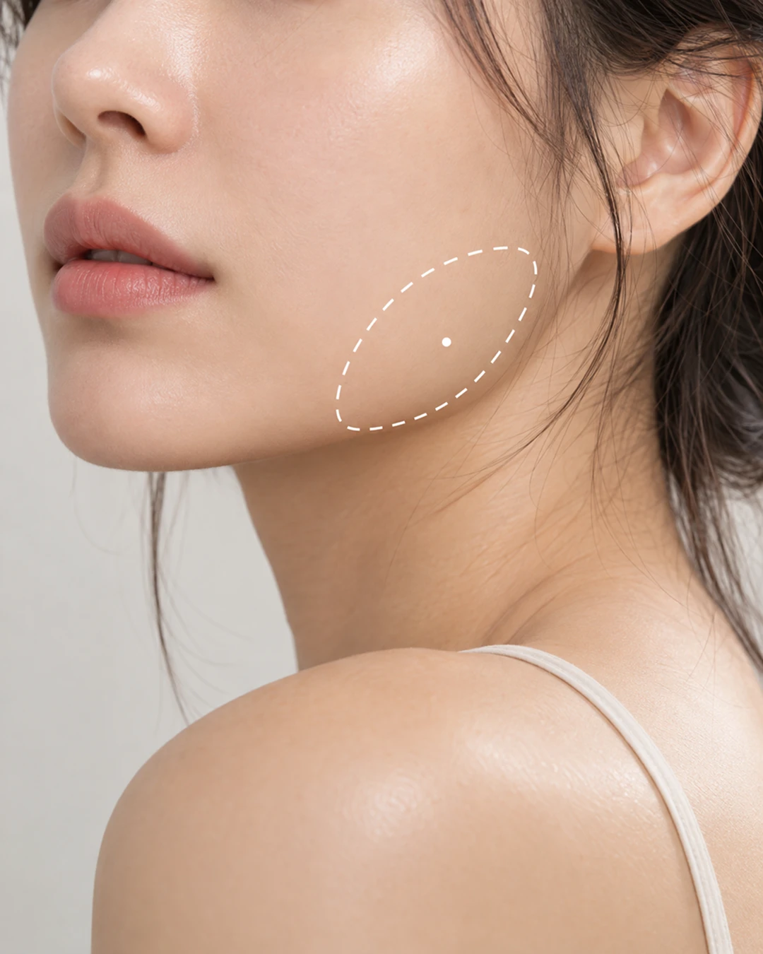 얼굴 옆선이 부어 보인다면? 귀밑 침샘 보톡스